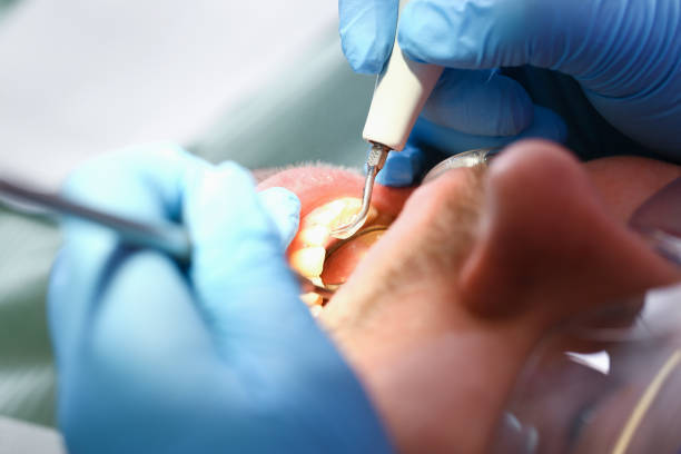 Best Broken Tooth Emergency  in Goodman, MO