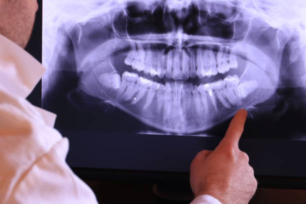 Best Emergency Tooth Extraction  in Goodman, MO